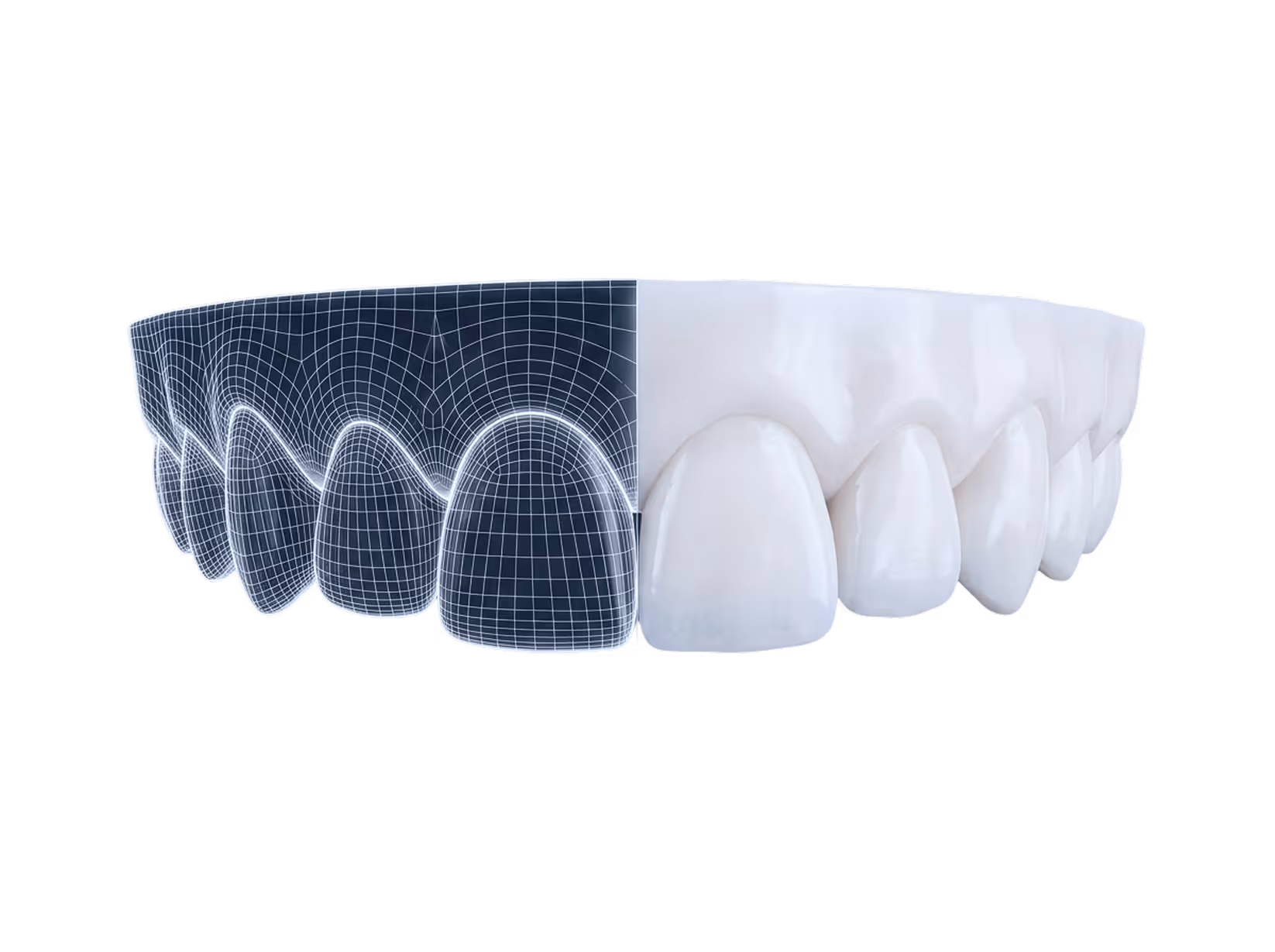 Zähne in 3D-Ansicht, eine Hälfte mit Drahtgittermodell, andere Hälfte realistisch weiß.