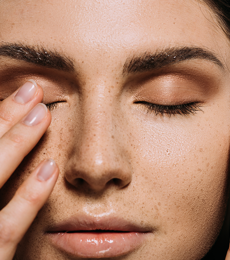 Clear skin results after laser treatment in Maitland
