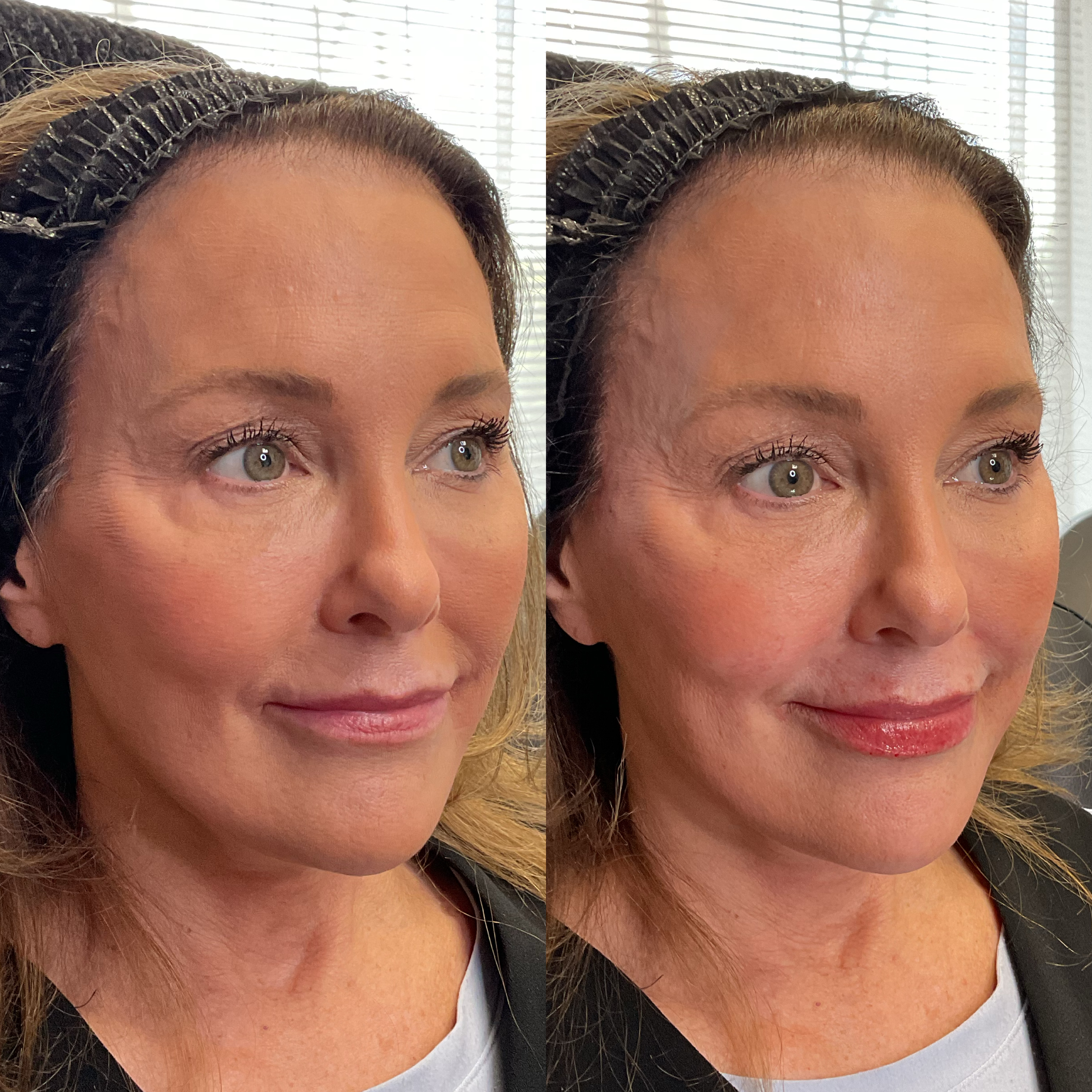 Facial Balancing Maitland FL