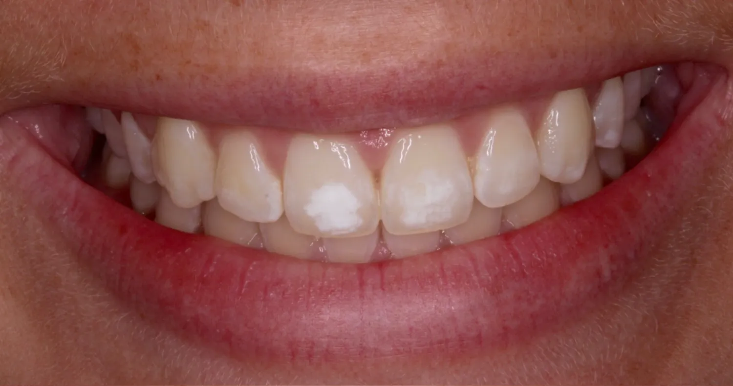 Before Image