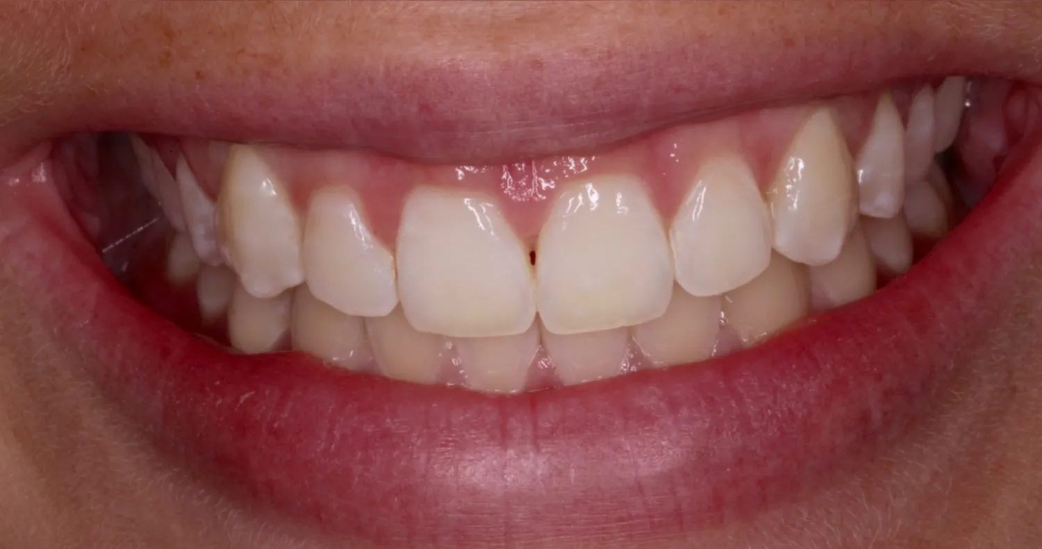After Image