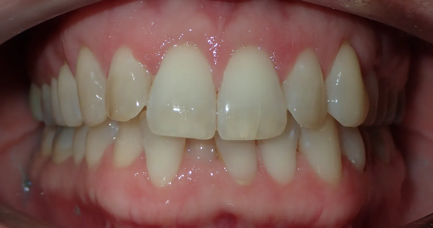 Before Image
