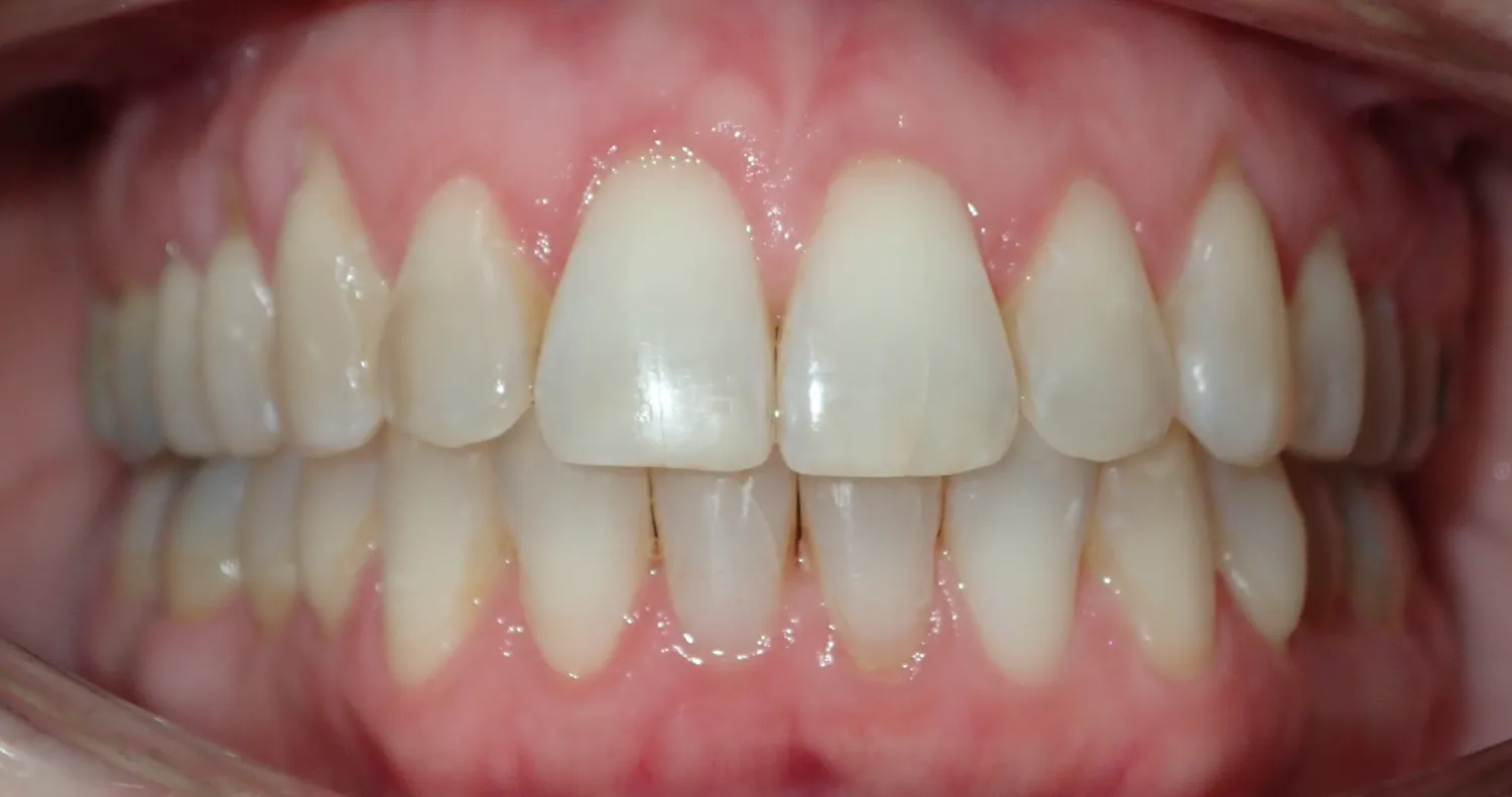 After Image