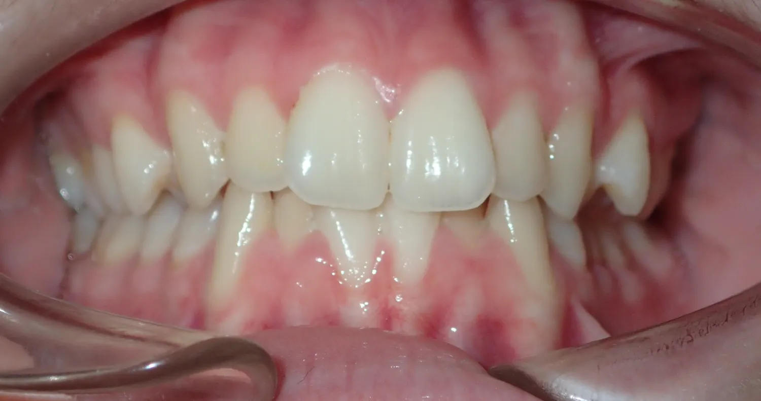 Before Image