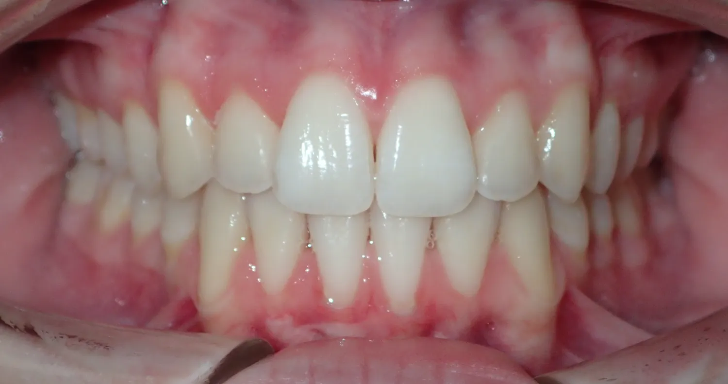 After Image