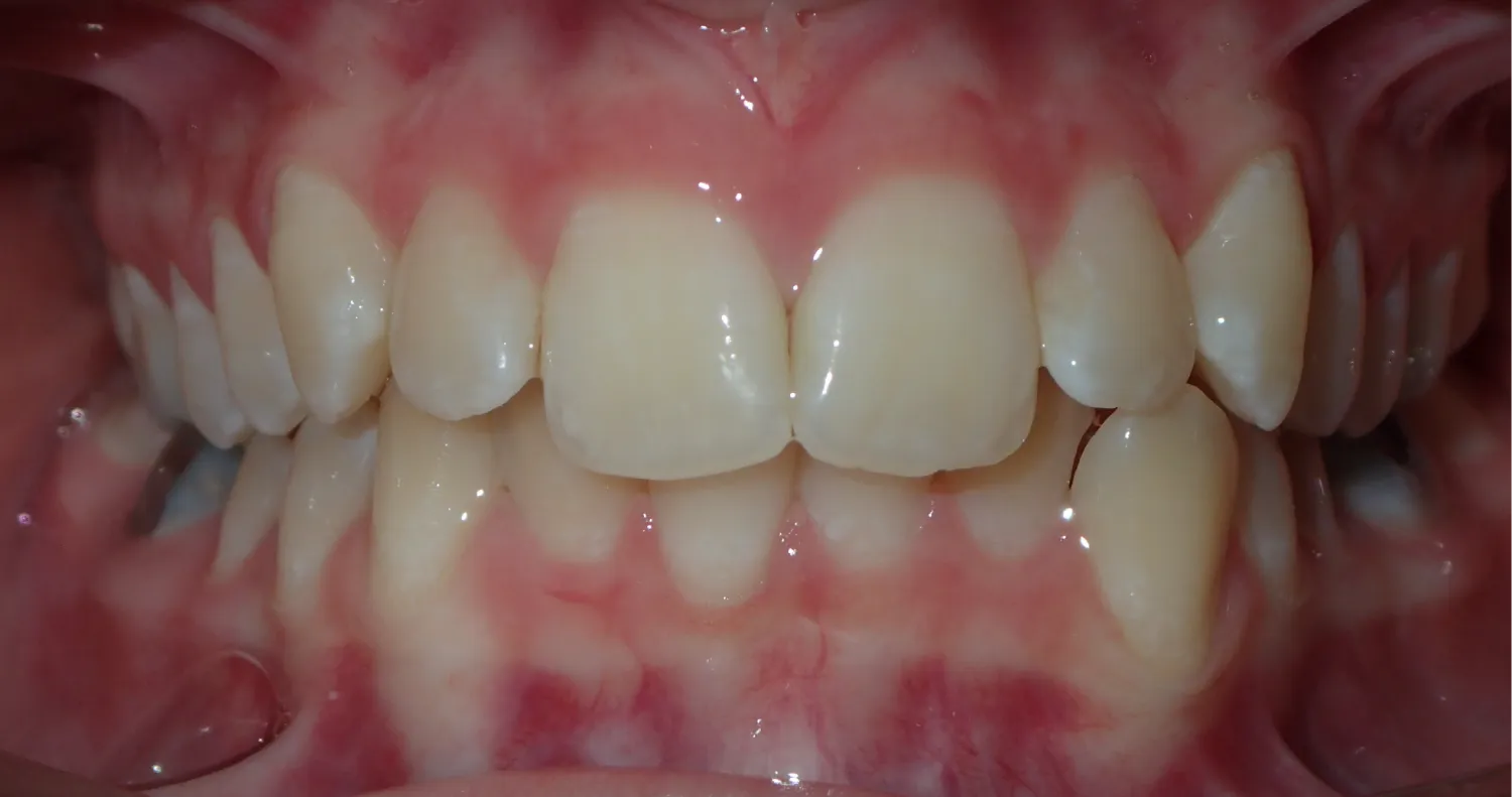 Before Image