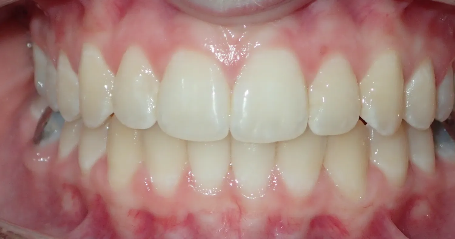 After Image