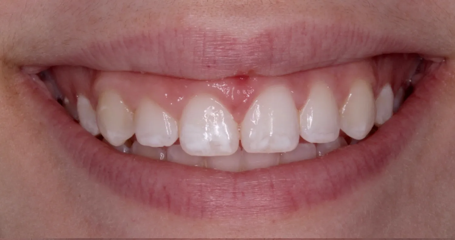 Before Image
