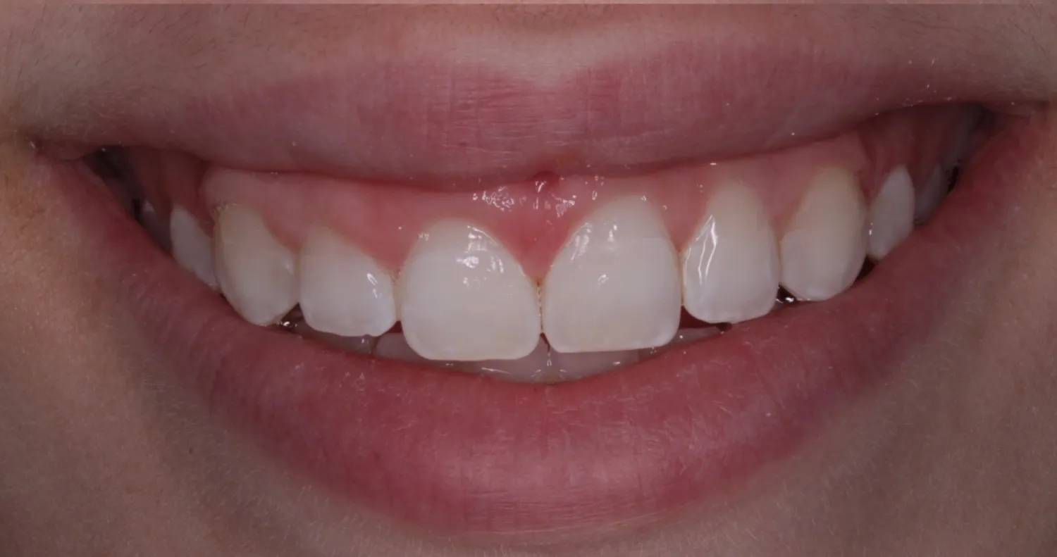 After Image
