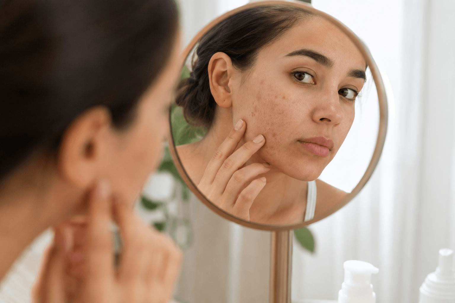 Client receiving laser skin treatment for dark spots at a medspa in Santa Clara, California