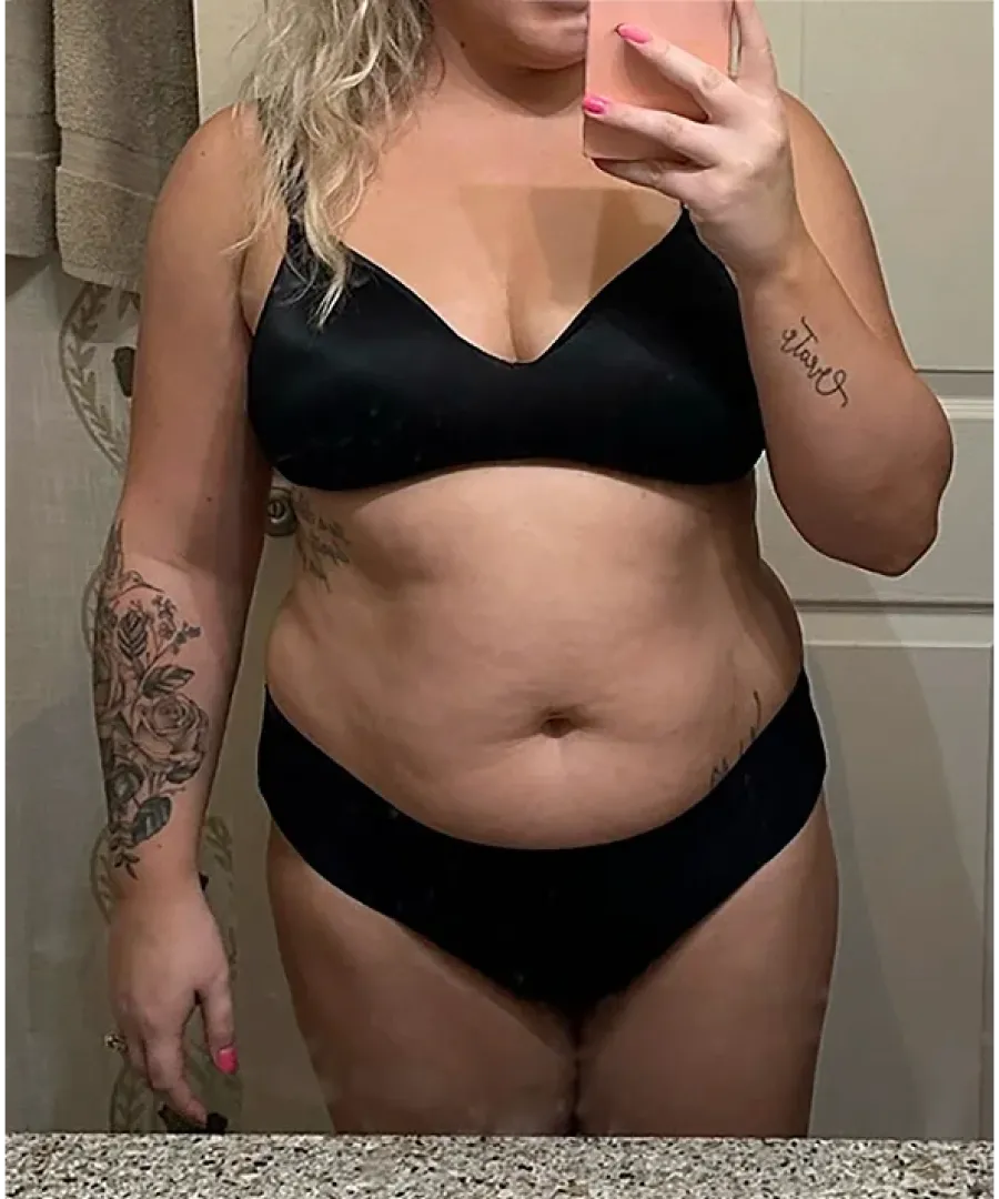 Melissa before her weight loss transformation