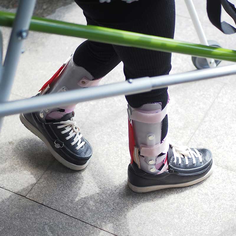 Child wearing black shoes and leg braces uses a walking frame on a tiled floor.
