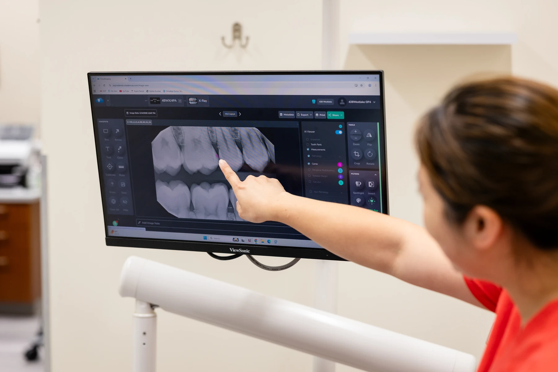 Dentist pointing to a tooth on a digital X-ray during diagnosis