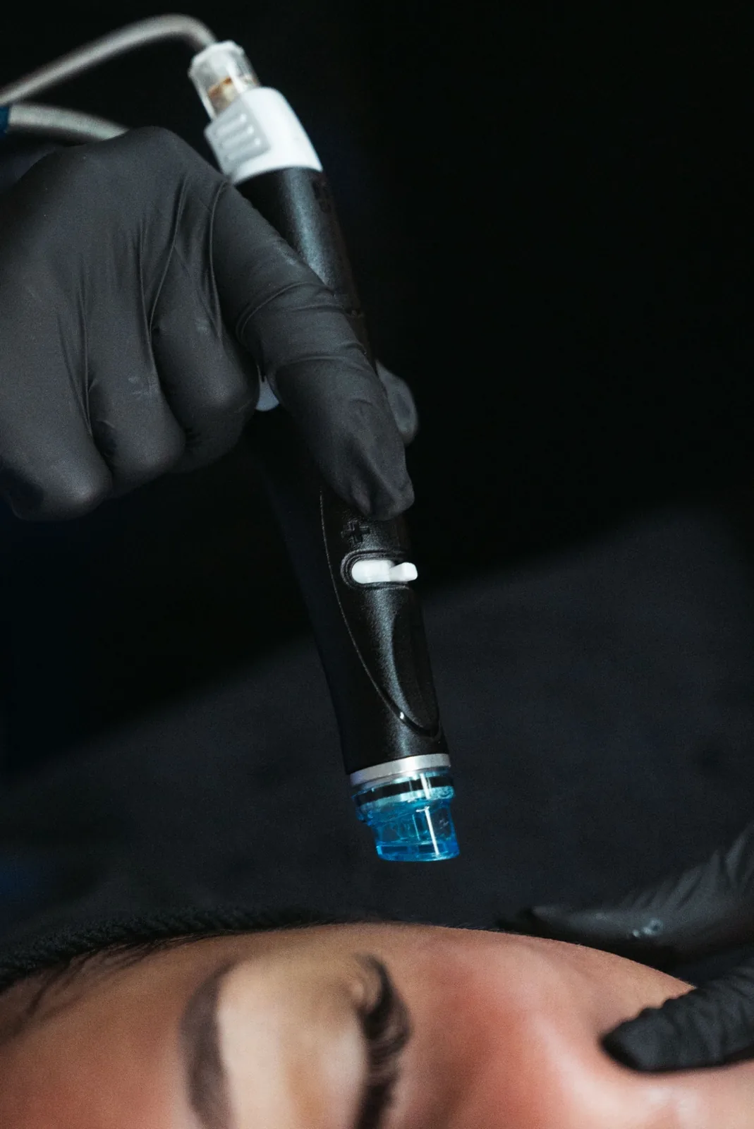 Hydrafacial treatment device used during facial treatment at BevelUp Tampa