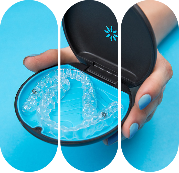 Hand with blue nails holding an open black and blue case containing clear dental aligners with metal attachments.