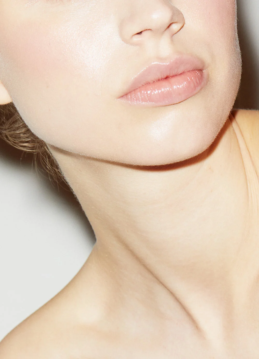 facelifting-hals-kinn-ergebnis-dr-charlotte-kleeberger-muenchen