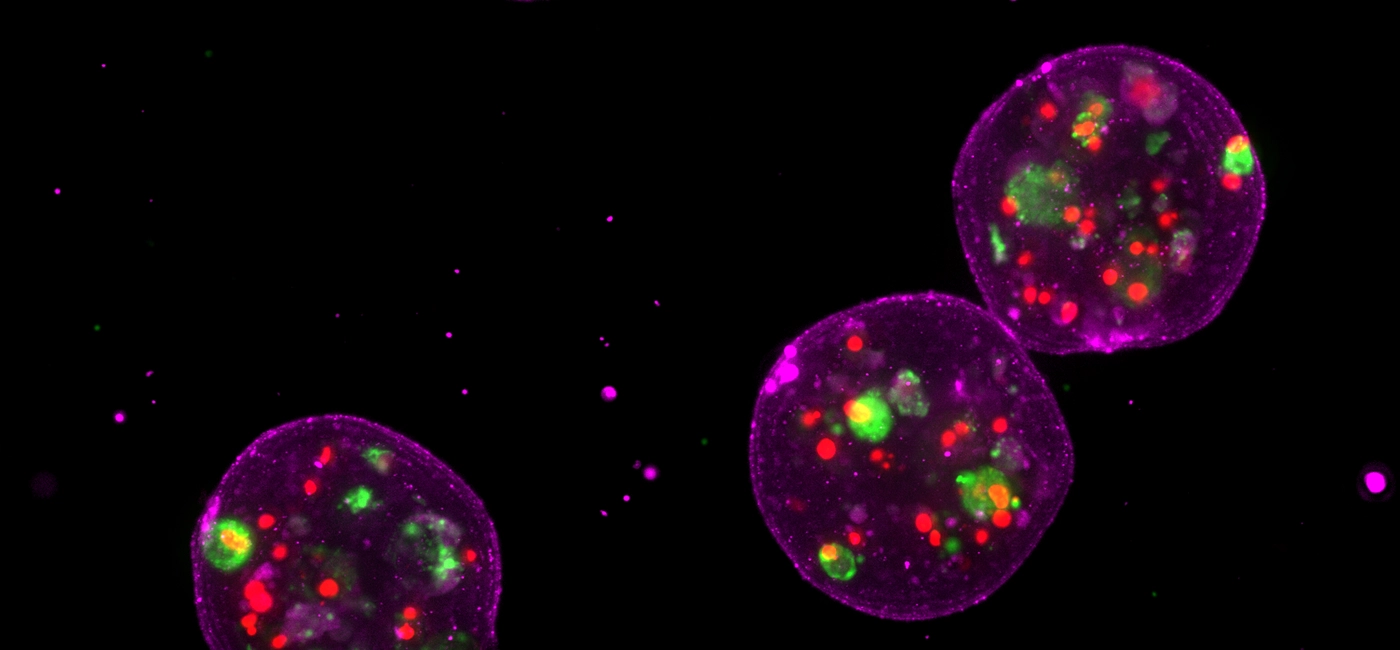Live patient-derived organoid inside MOS