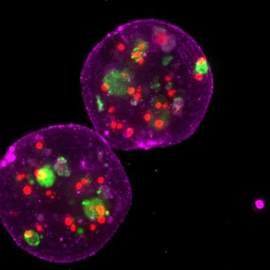 MOS (magenta) containing live patient organoids