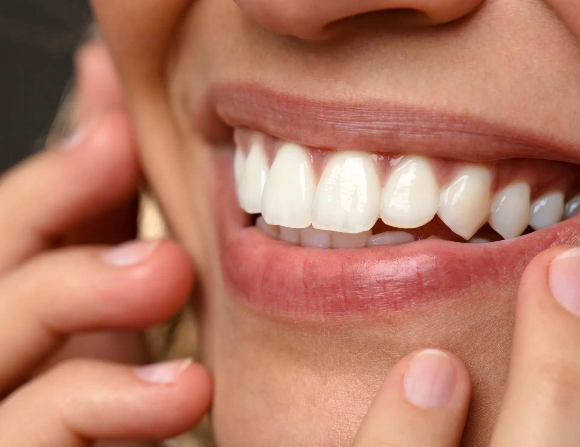 Close-up of a woman's smile with her fingers gently pulling back her cheek