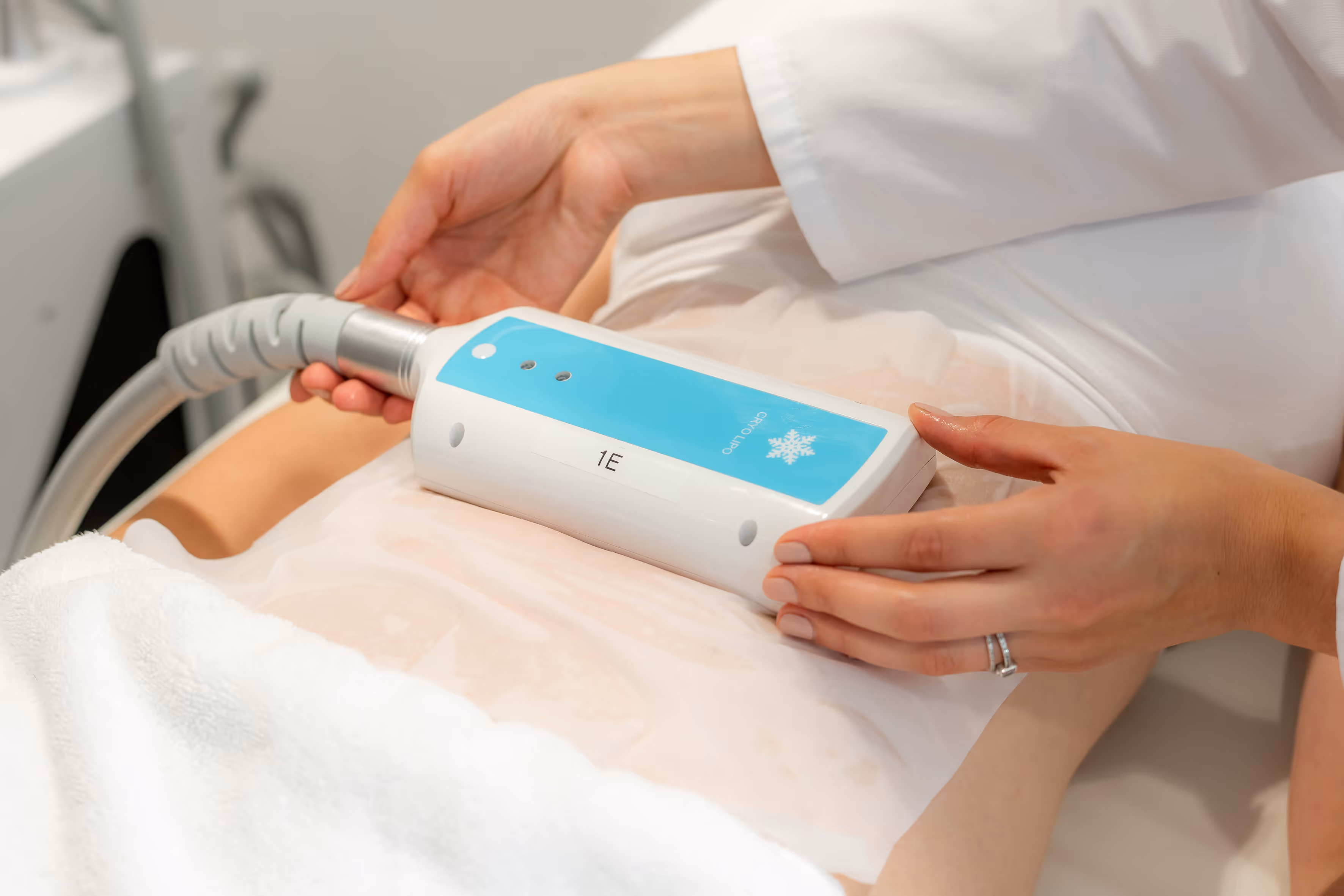 Hand hält Gerät für Kryolipolyse-Behandlung auf dem Bauch einer Person.