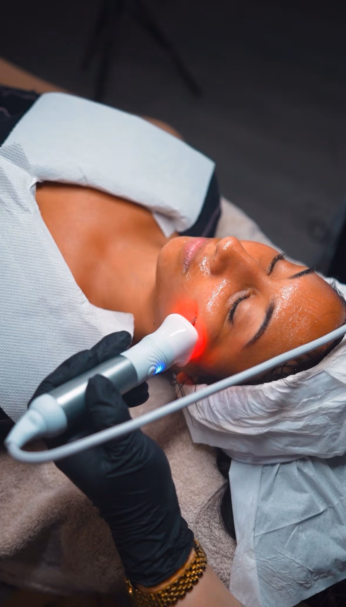 Hydrafacial at Rose Hill Clinics - Altura Growth
