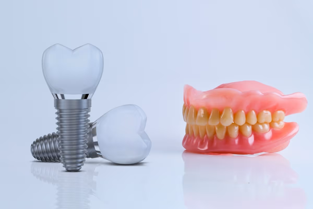 Dental Implants Vs. Dentures - How Implants Can Help