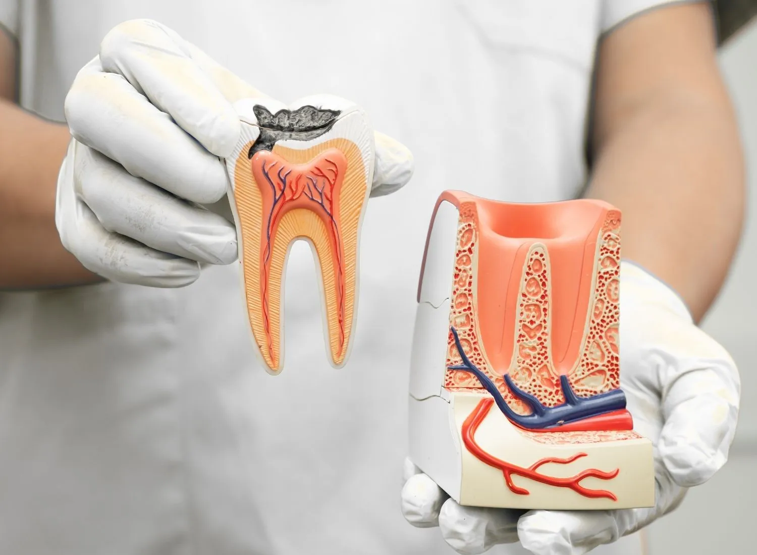 Hands in white gloves holding detailed dental cross-section models showing tooth and bone structure.