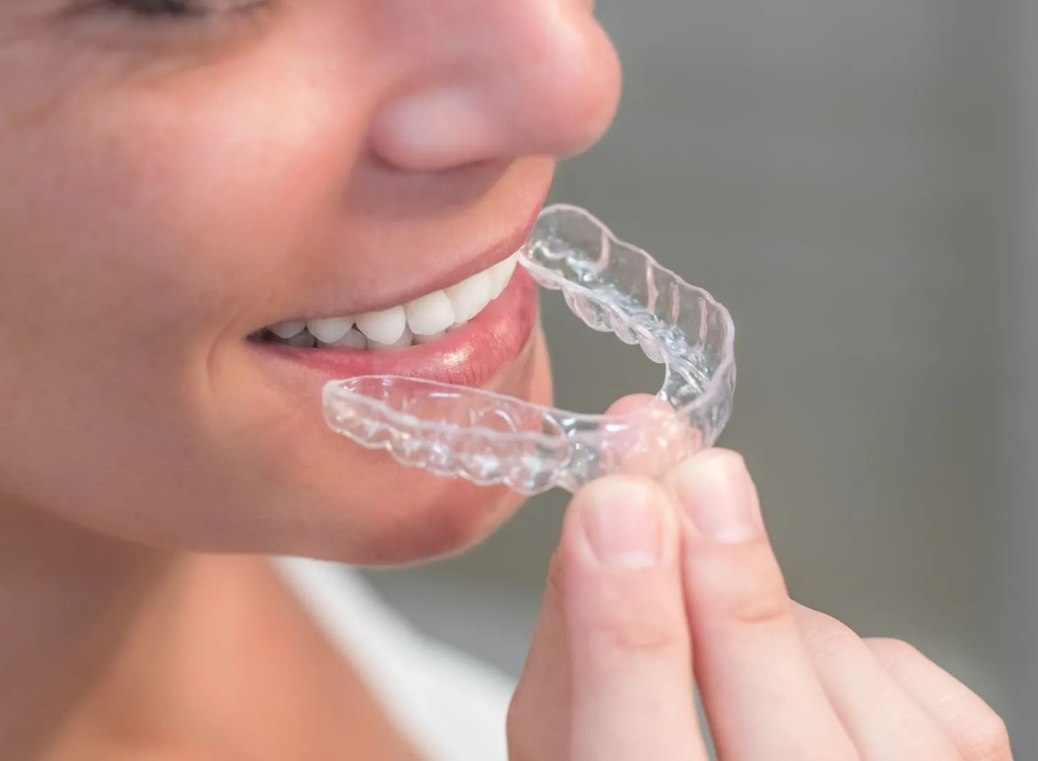 Person holding a clear dental mouthguard near their mouth, showing white teeth and smile.