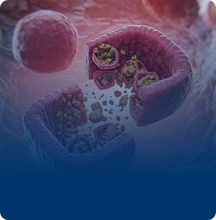 Mitochondrial Dysfunction