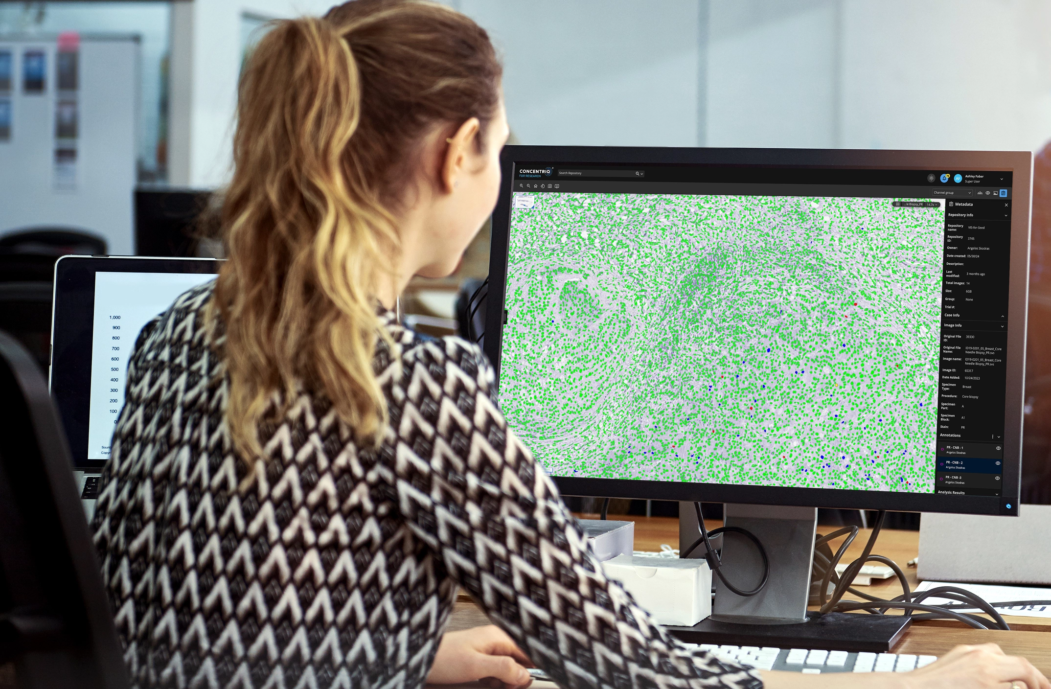 Woman with ponytail analyzing microscopic image with green markers on a desktop monitor at office.