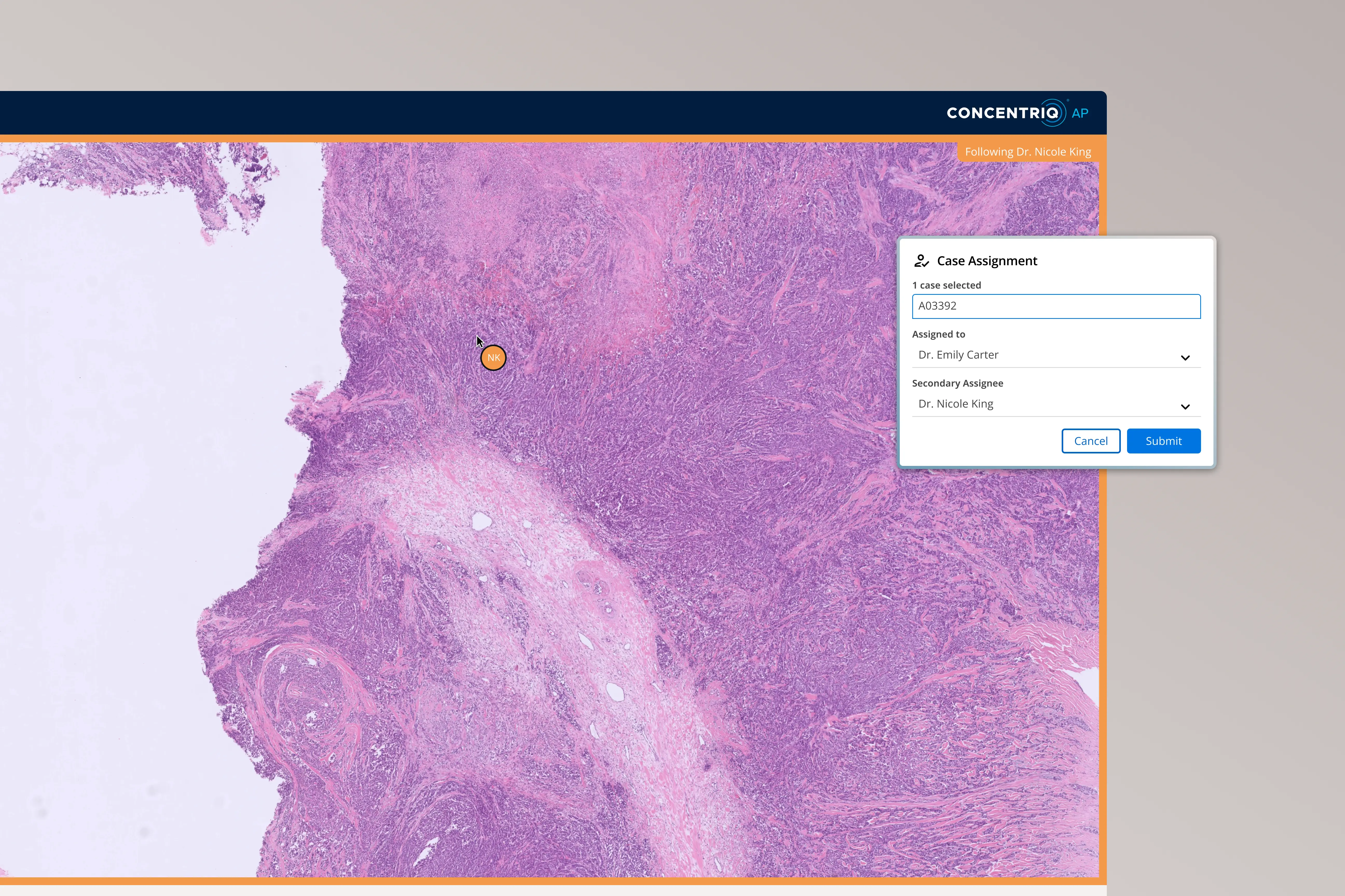 Microscopic image of tissue with case assignment popup for Dr. Emily Carter and Dr. Nicole King.