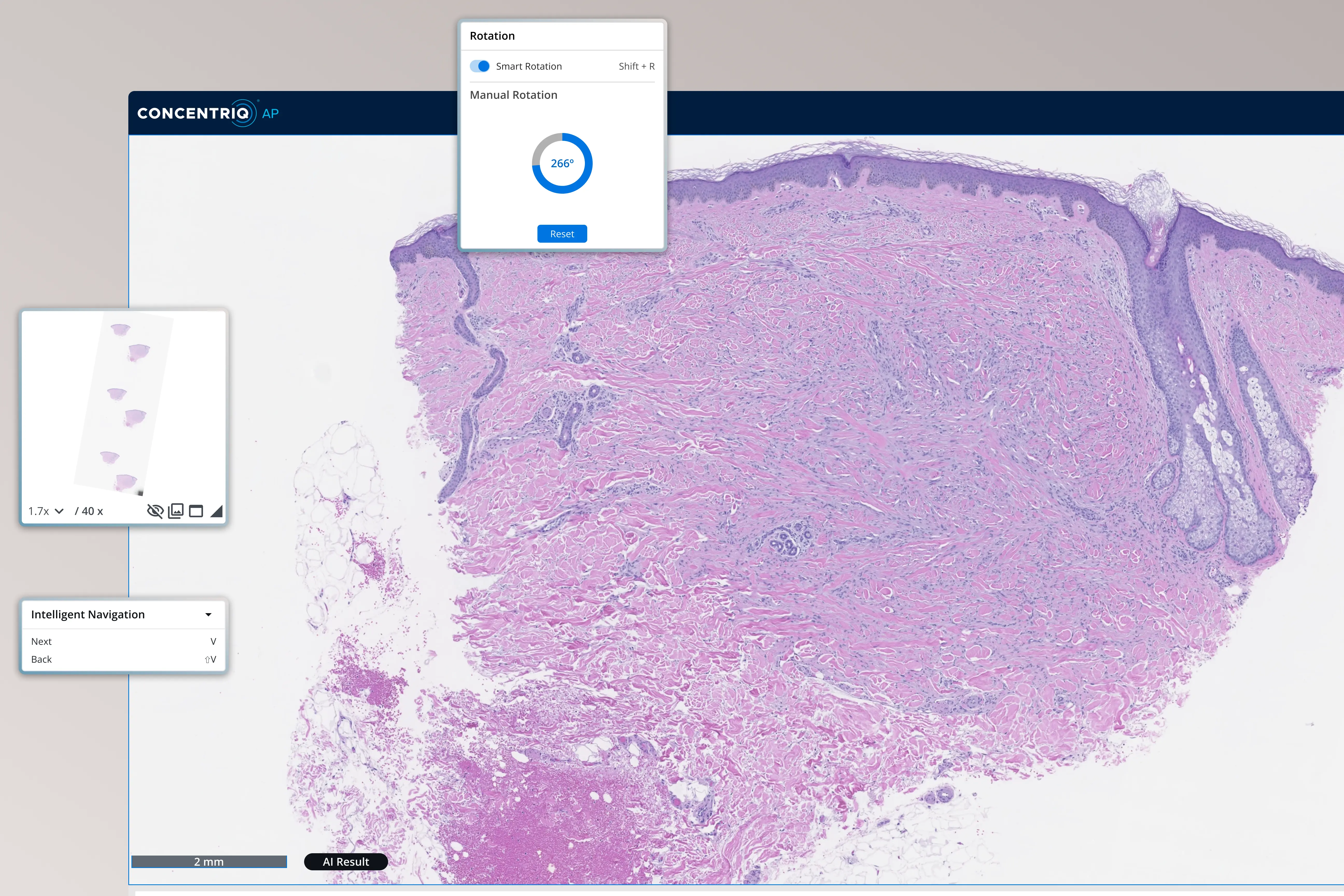 Digital microscope interface showing a rotated purple and pink histology skin tissue sample.