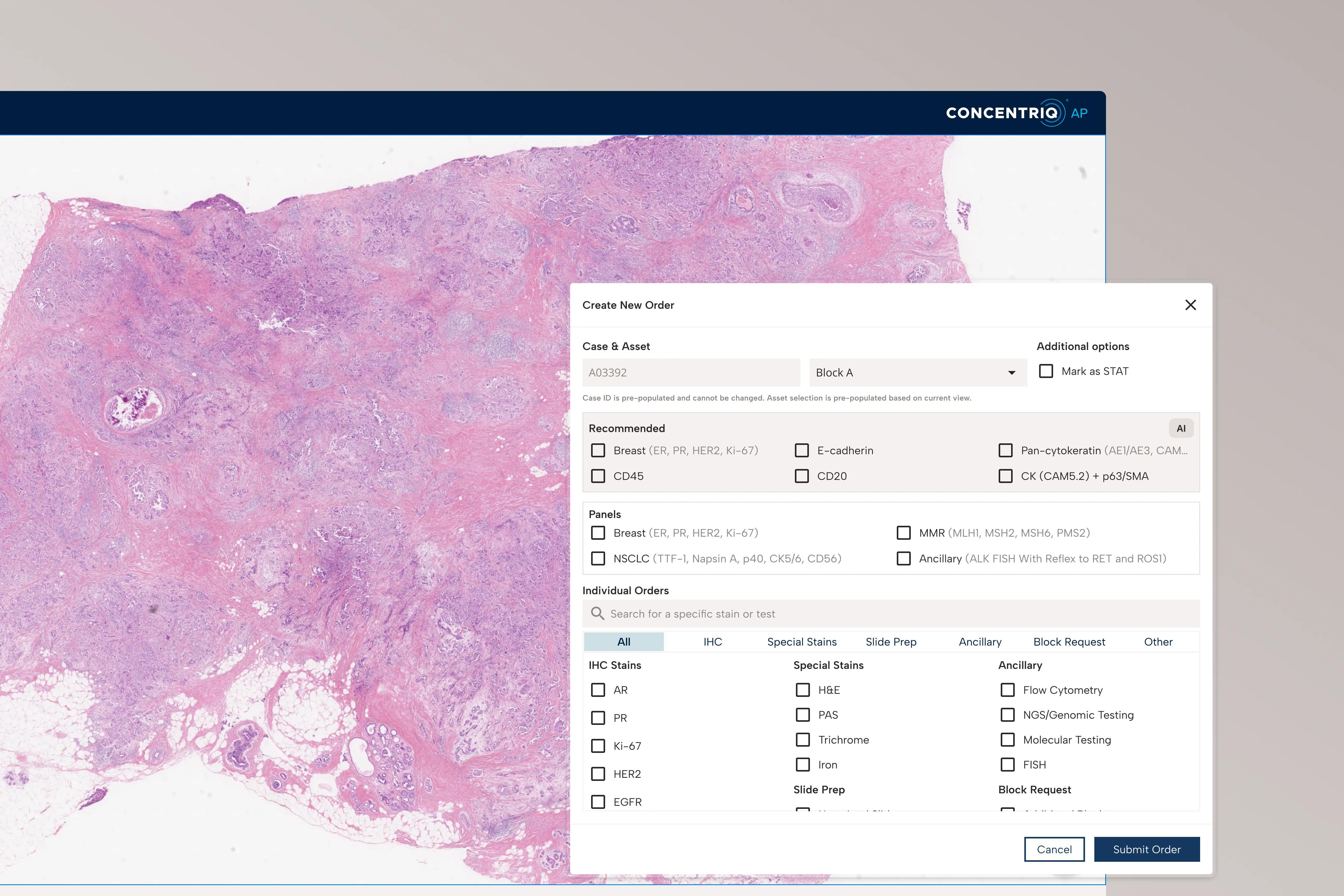 Digital pathology interface showing tissue slide image and a pop-up window for creating a new order with lab test options.