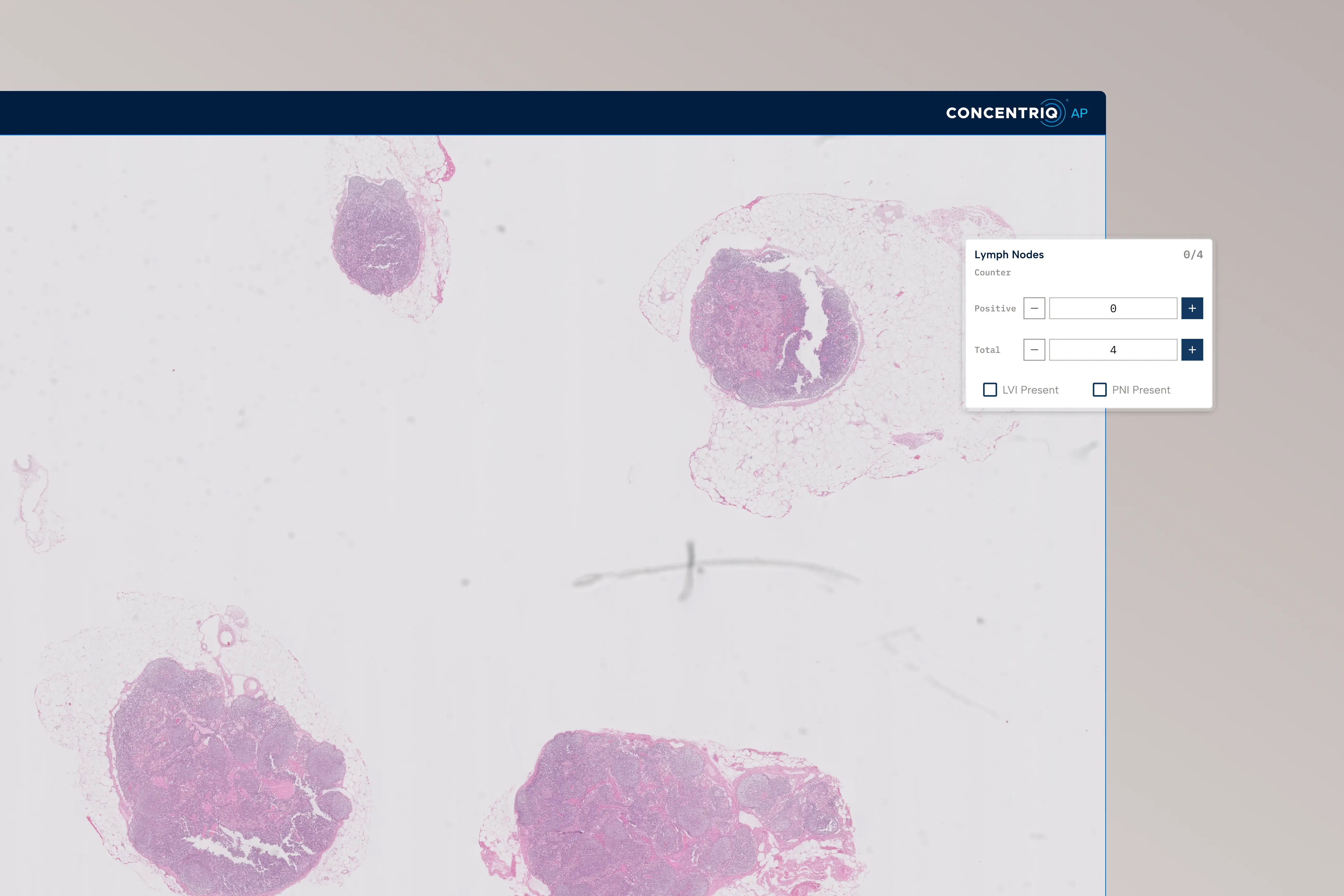 Digital view of four lymph node tissue samples with a lymph node counter interface on the top right.