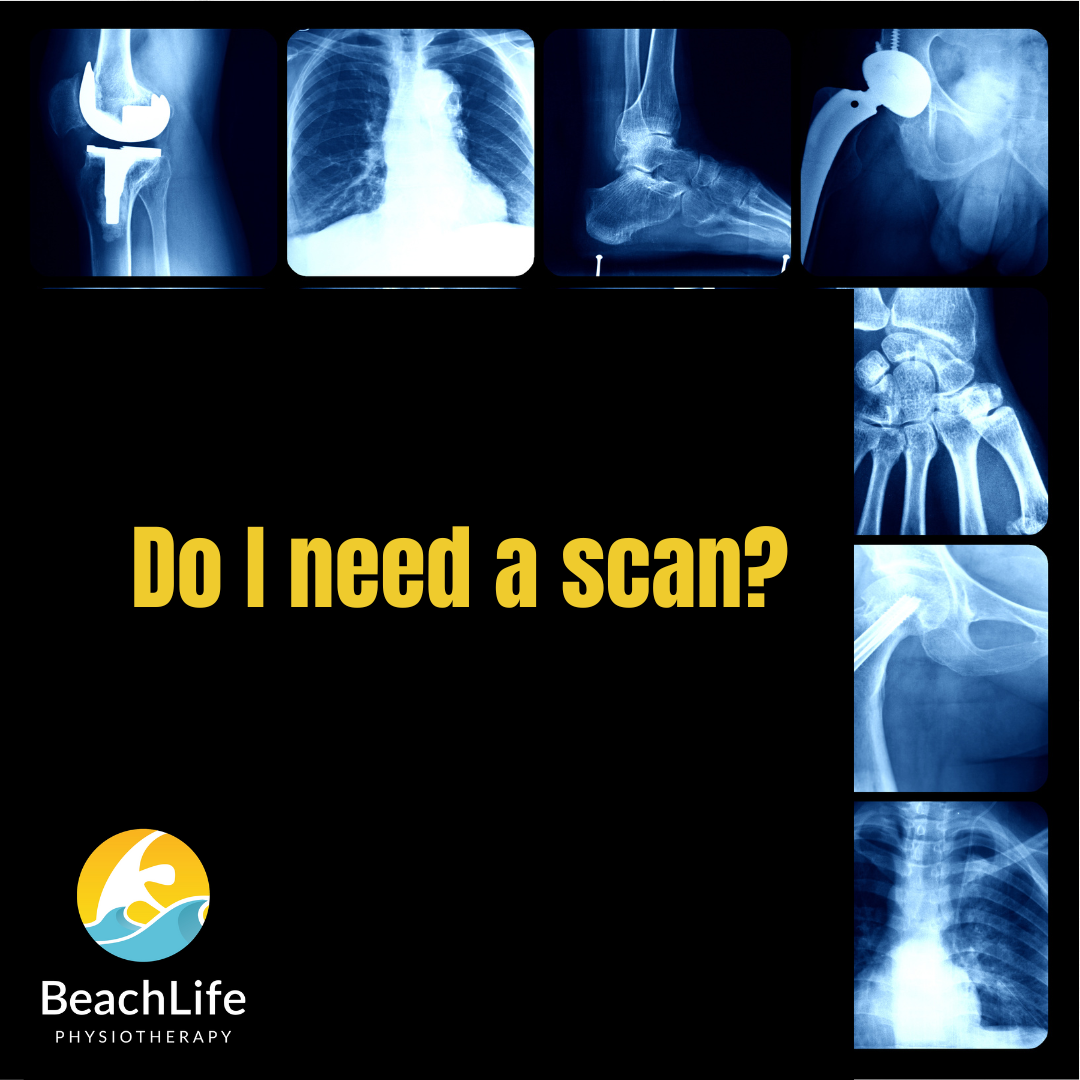 Featured image for Do I need a scan ?