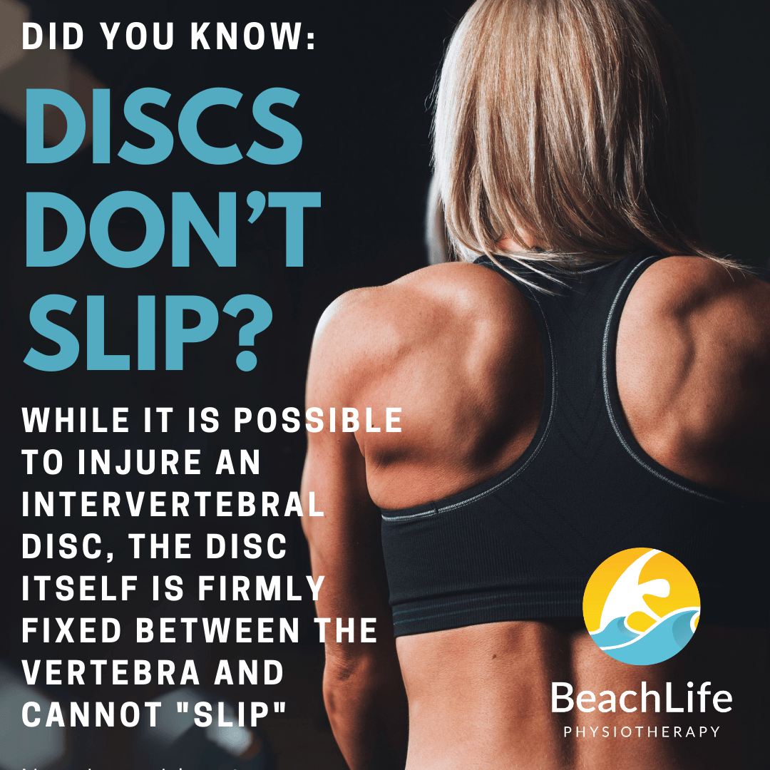 Featured image for Misconceptions About Intervertebral Discs