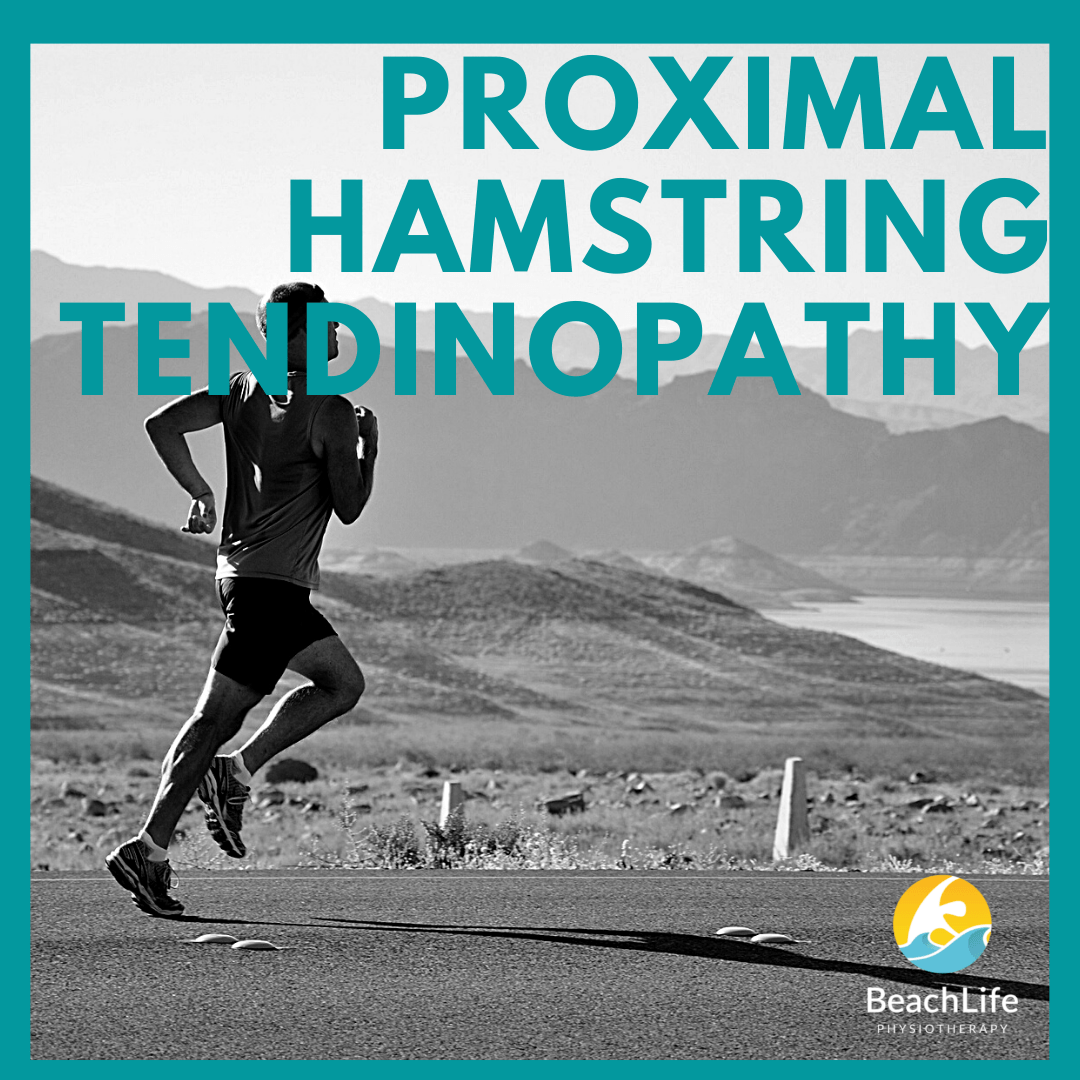 Featured image for Proximal Hamstring Tendinopathy