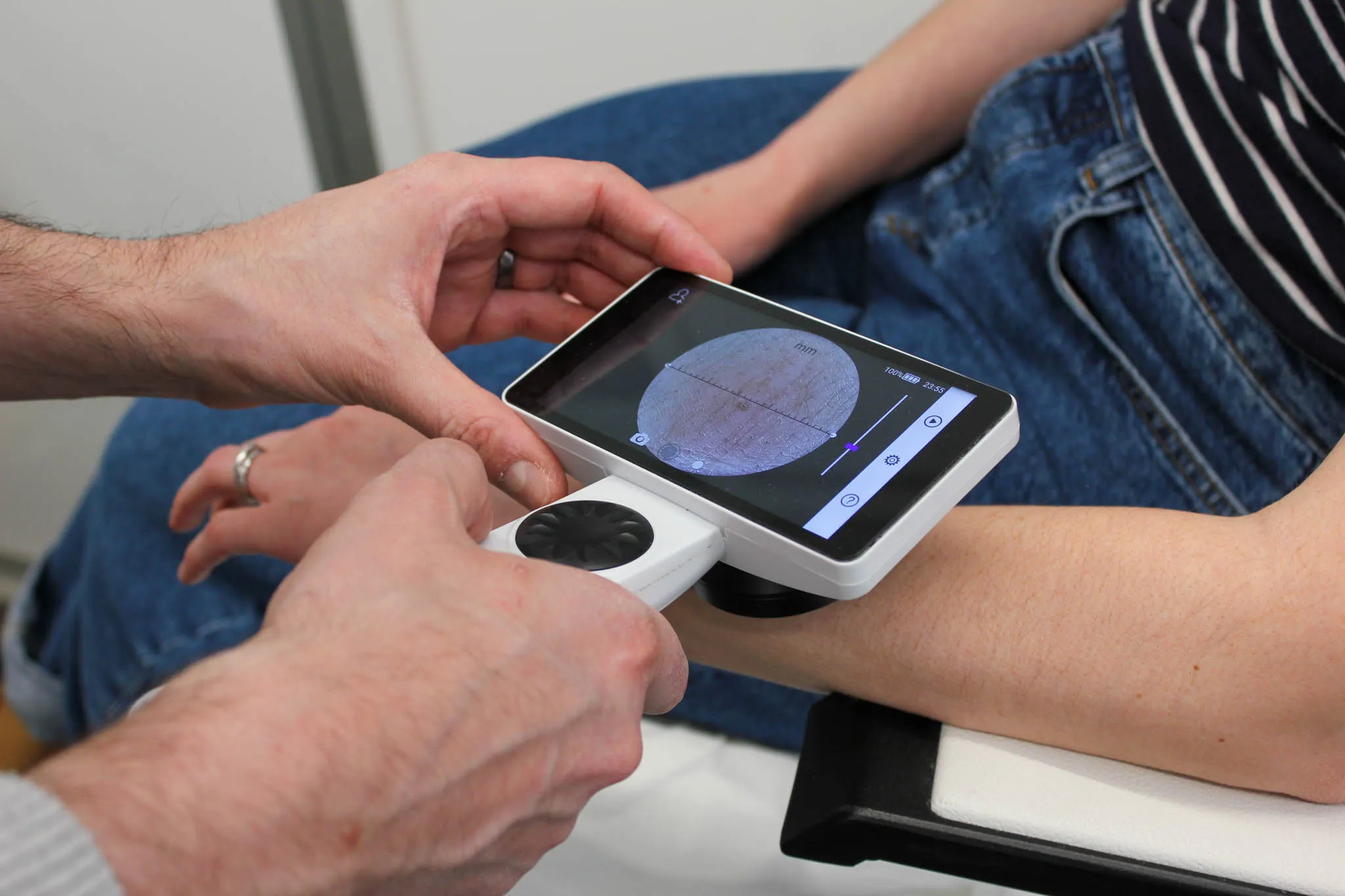 Examen dermatologique de dépistage à bord d'un bus médical Hocoia