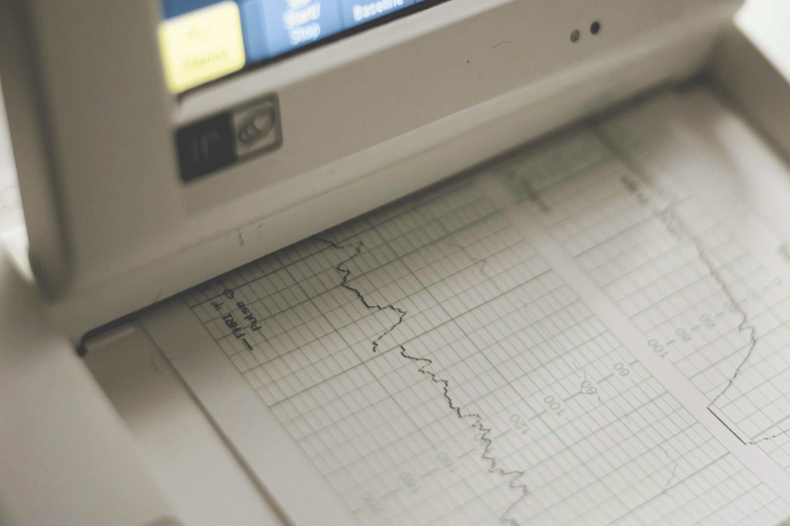 Examen cardiologique avec ECG