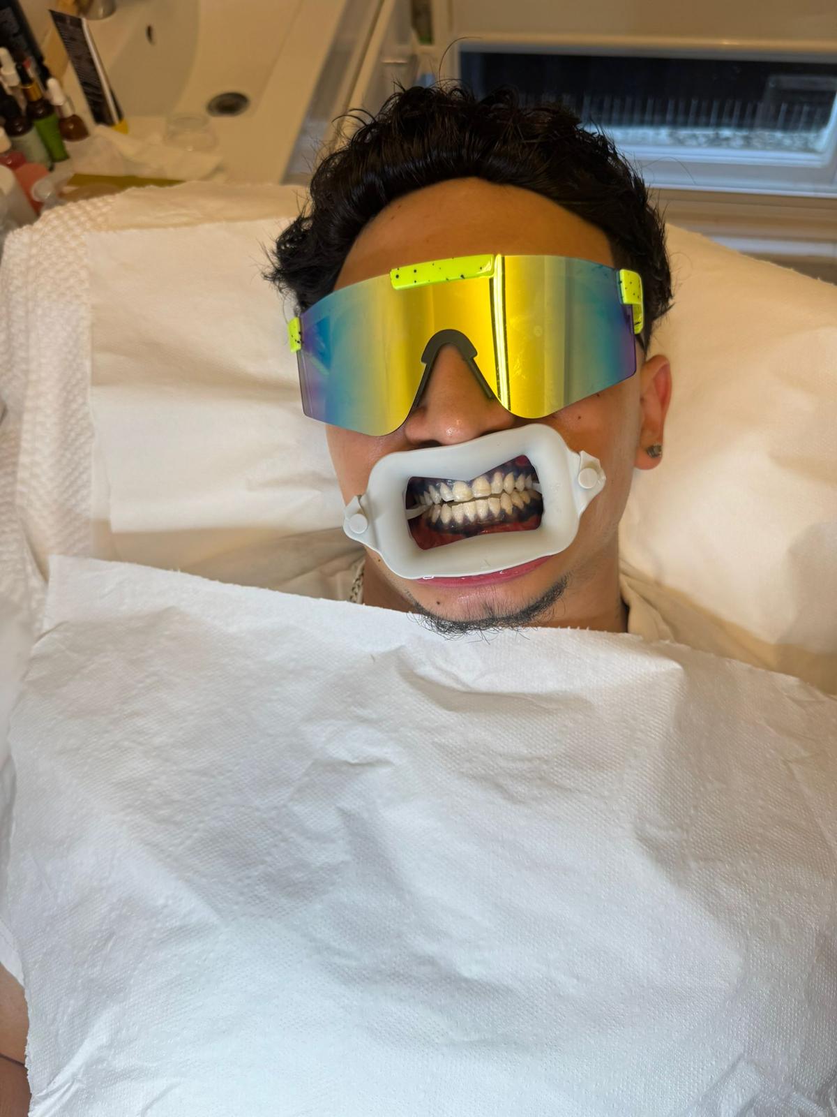 Teeth Whitening