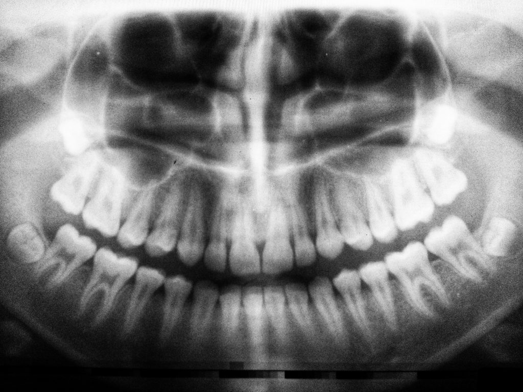 Dental Treatment Plan