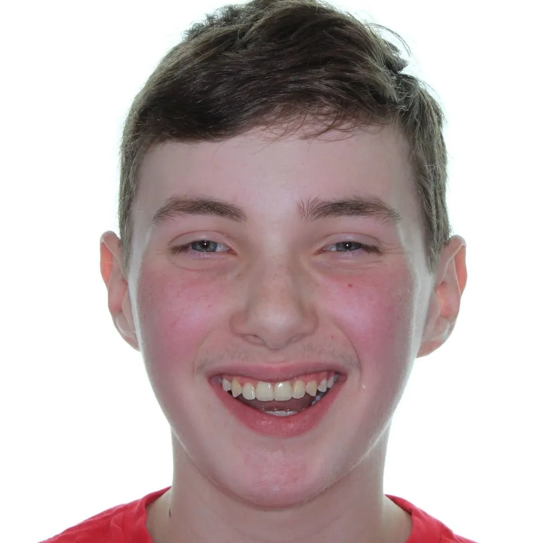 Young person with short brown hair smiling with teeth visible wearing a red shirt against white background.