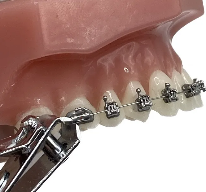 Close-up of dental braces being adjusted on a dental model with a tool.