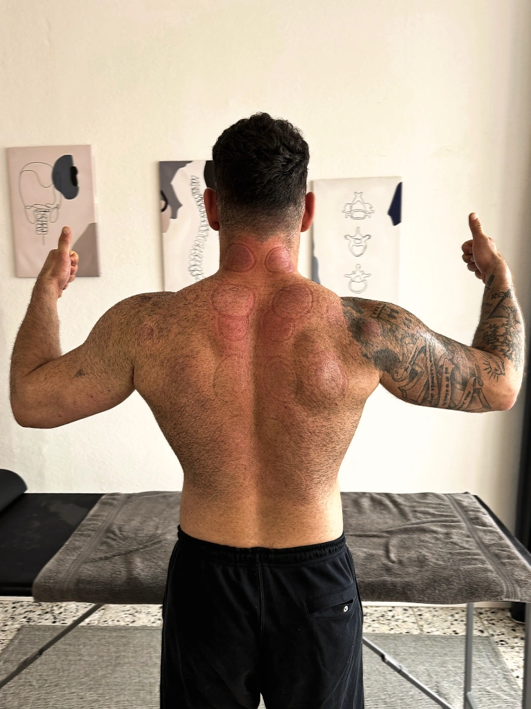 Sportmassage in Kassel – Ergebnis nach Behandlung