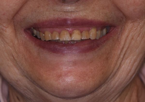 Before Image