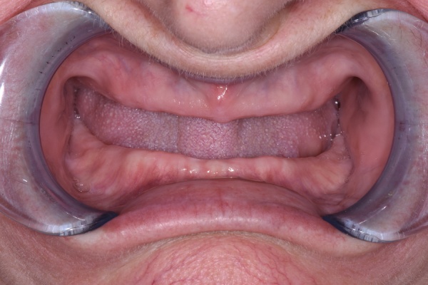 Before Image