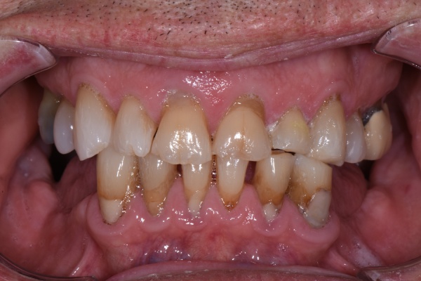 Before Image