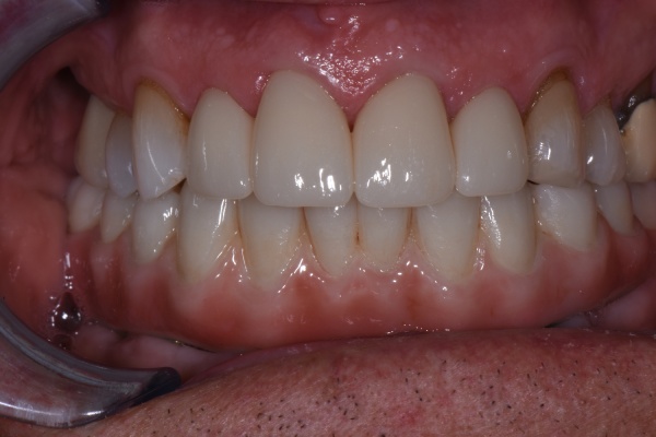 After Image