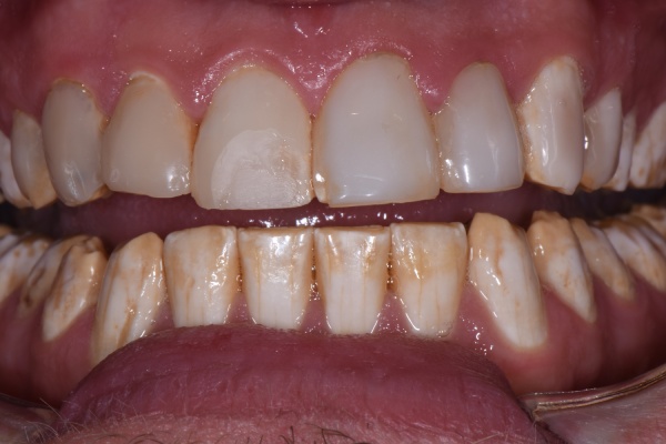 Before Image