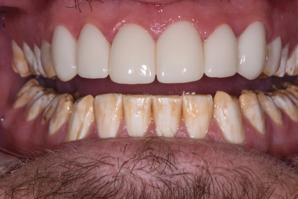 After Image